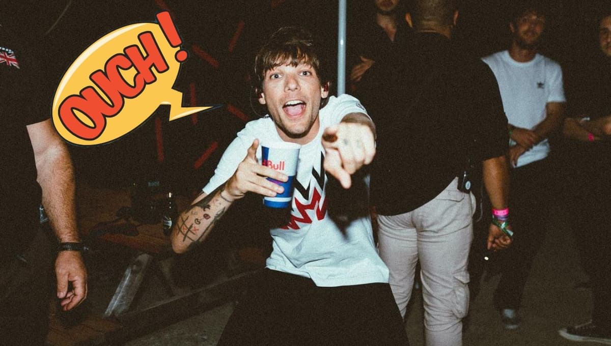 ¿Qué le pasó a Louis Tomlinson? Accidente deja al ex One Direction con un brazo roto